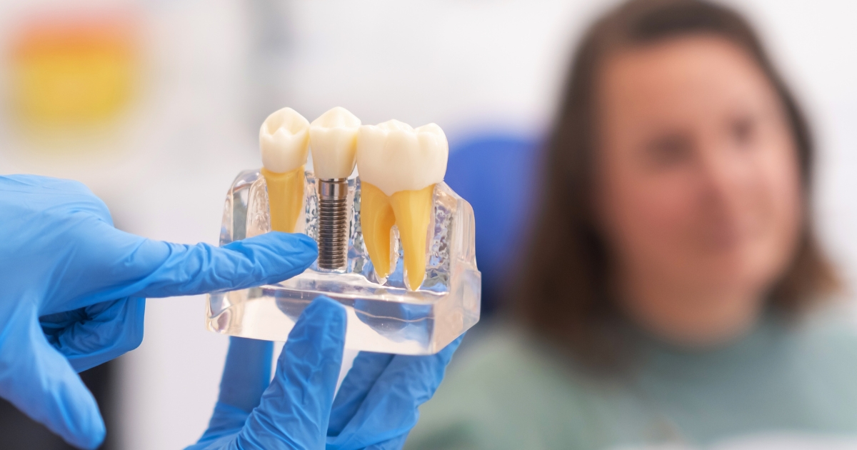 Dental Implant Aftercare Guidelines for Ensuring Durability - Woodcreek Family Dentistry