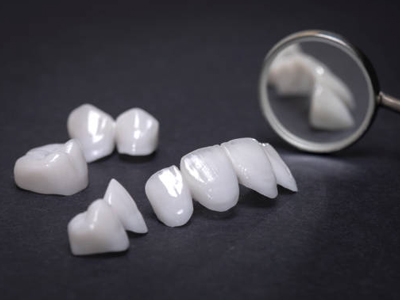 Porcelain Crowns - Cosmetic Dentist in Katy, TX